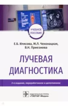 Лучевая диагностика. Учебное пособие