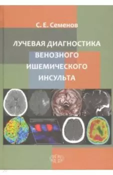 Лучевая диагностика венозного ишемического инсульта