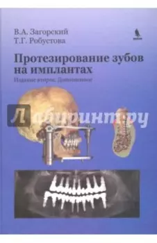 Протезирование зубов на имплантатах