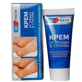 ДО И ПОСЛЕ Крем для ног от трещин в ступнях 50.0