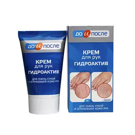 ДО И ПОСЛЕ Крем для сухой кожи рук Гидроактив 100.0