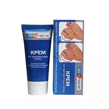 ДО И ПОСЛЕ Крем от пигментных пятен 50.0