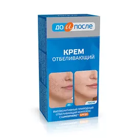 ДО И ПОСЛЕ Крем Отбеливающий 100.0