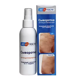 ДО И ПОСЛЕ Сыворотка антицеллюлитная 130.0