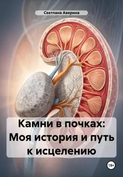 Камни в почках: Моя история и путь к исцелению