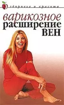 Варикозное расширение вен