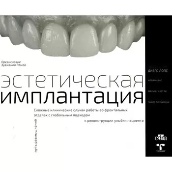 Эстетическая имплантация. Сложные клинические случаи работы во фронтальных отделах с глобальным подходом к реконструкции улыбки пациента. Лопс Д., Абас И., Гизотти М., Пиччиокки Г.