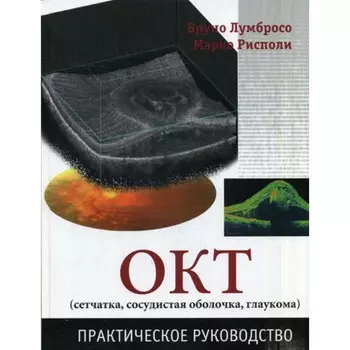 ОКТ (сетчатка, сосудистая оболочка, глаукома). Практическое руководство. Лумбросо Б., Рисполи М.