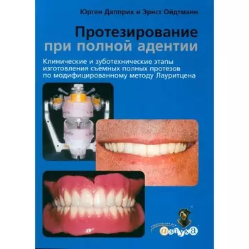 Протезирование при полной адентии. Клинические и зуботехнические этапы изготовления съемных полных протезов по модифицированному методу Лауритцена. Дапприх Ю., Ойдтманн Э.