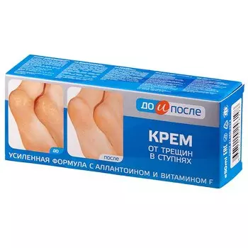 До и После Крем для ног от трещин в ступнях 50 мл