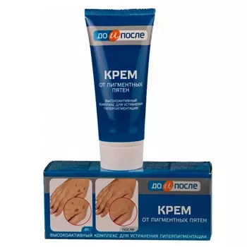 До и После Крем от пигментных пятен 50 мл