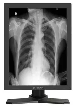 Монитор 21,3" RESHIN MD26GA 2 МП, монохромный, наличие РУ