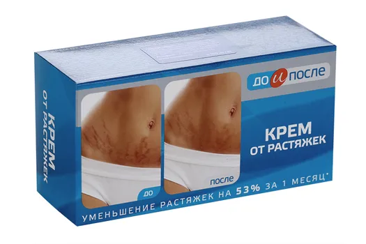 Крем TWINS Tec от растяжек до и после д/тела, 100 мл