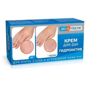Крем для сухой кожи рук Гидроактив "До и после"