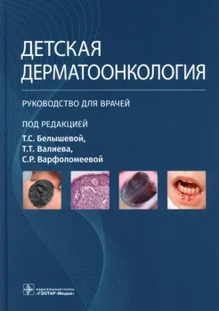 Детская дерматоонкология. Руководство для врачей