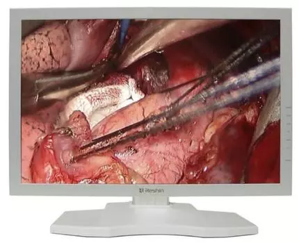 Монитор 24" RESHIN MS247SA 1920x1200, наличие РУ